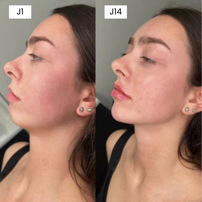 Gaine Visage Fit Mask